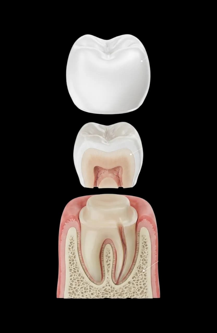 Anatomia unei coroane