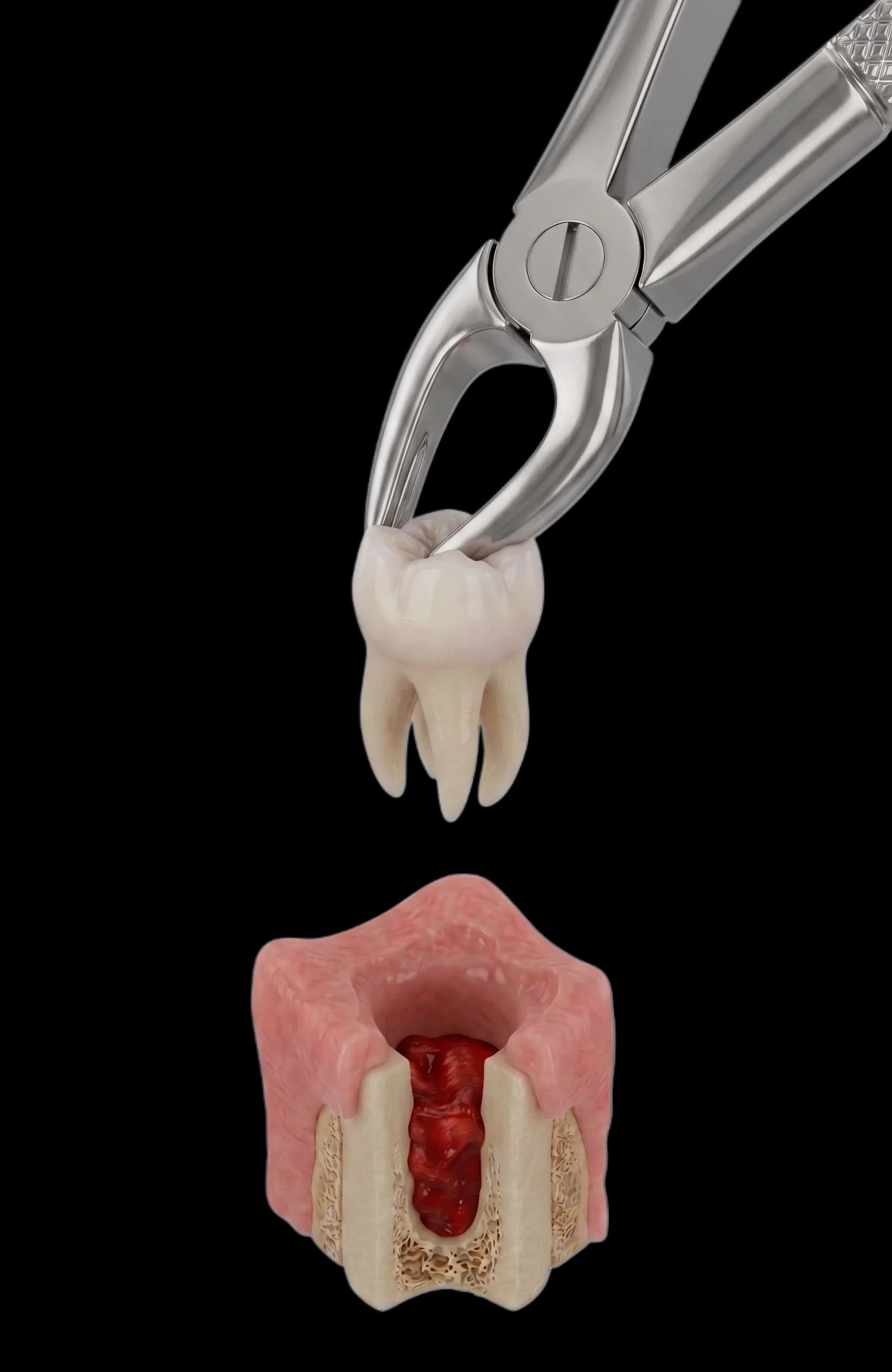 Anatomia extracției dentare