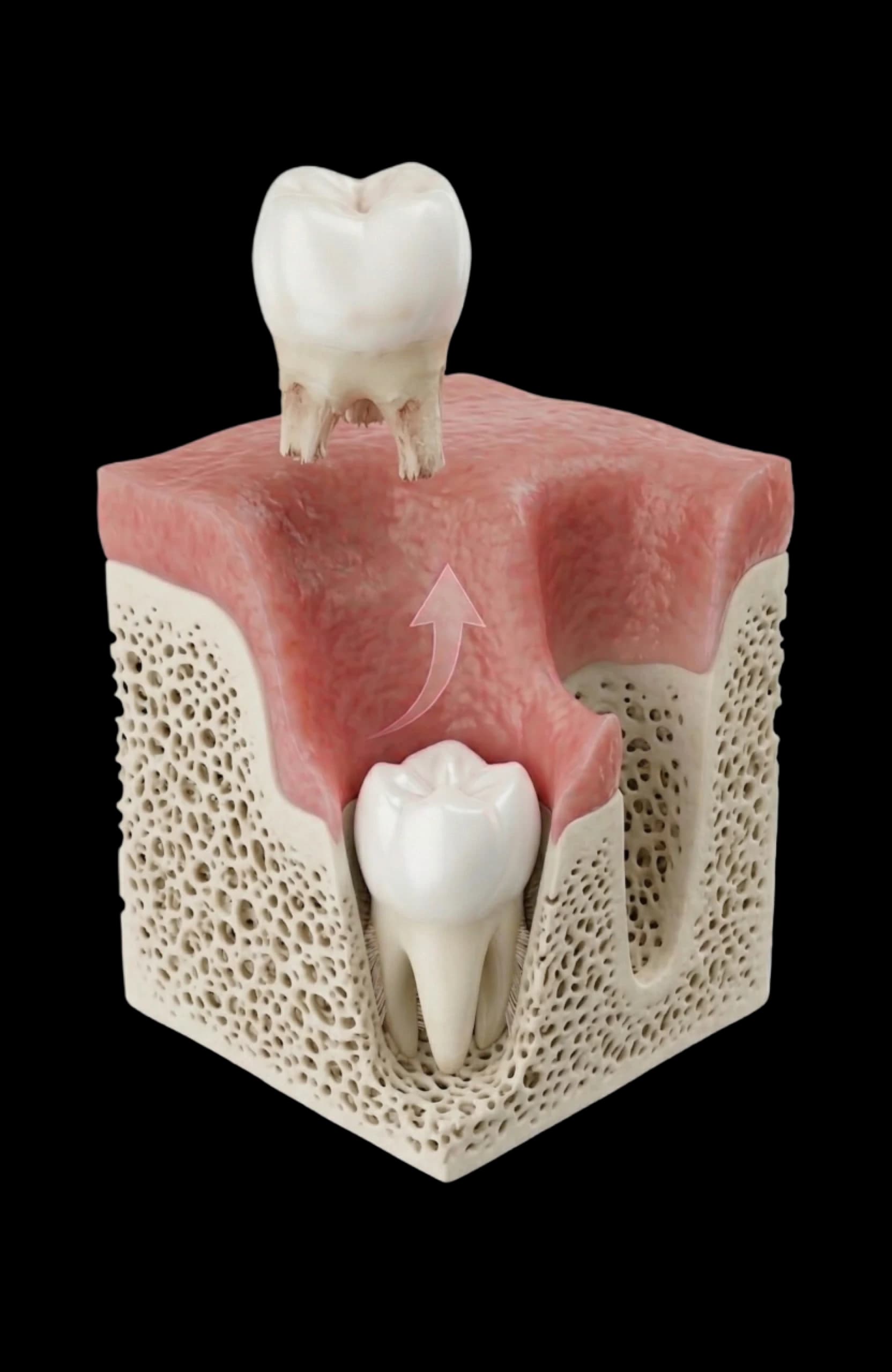 Extracția dentară