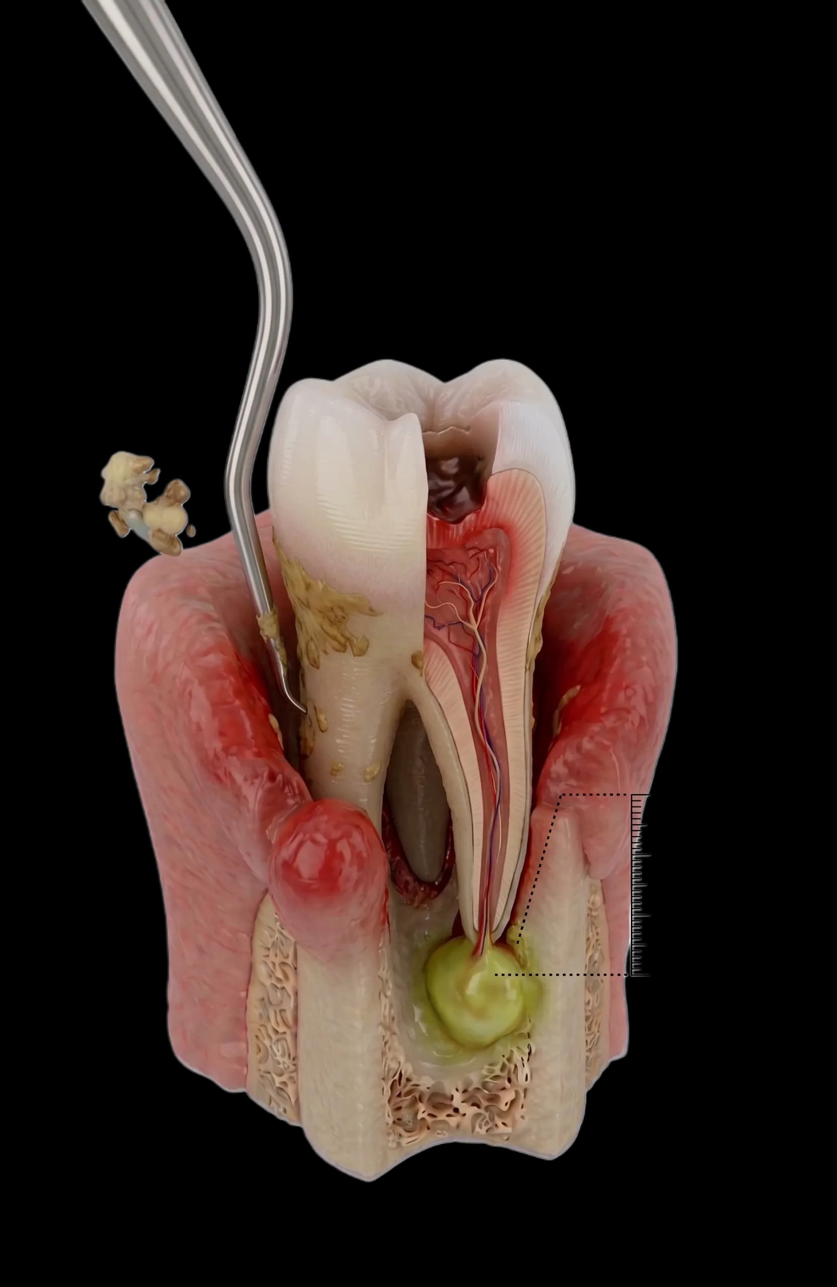 Anatomia unei urgențe dentare